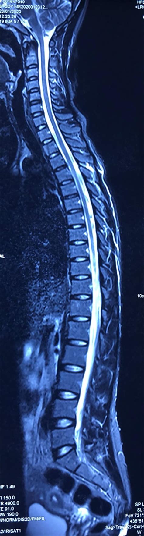 Full Length Spine CT And MRI In Daily Practice Clinical Tree