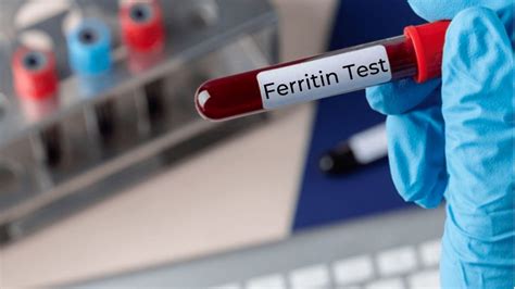 Ferritin Test Preparation Results And Levels Monomousumi