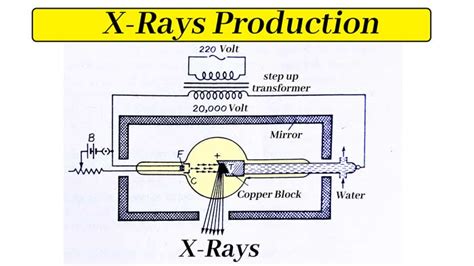 Production of x-ray - radiologystar