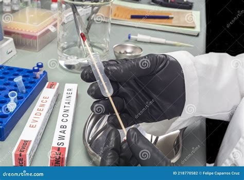 Police Expert Extracts Traces Of Blood In A Swab For Analysis In The