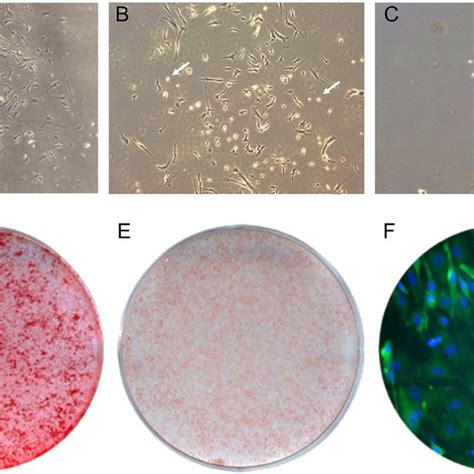 Morphology And Characterization Of Muscle Derived Stem Cells Mdsc At