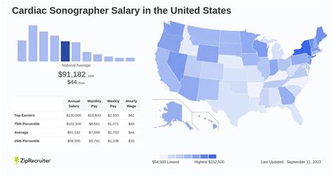 Cardiac Sonographer Salary Hourly Rate January 2025 USA