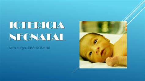 Ictericia Neonatal Lisbet Silva UDocz