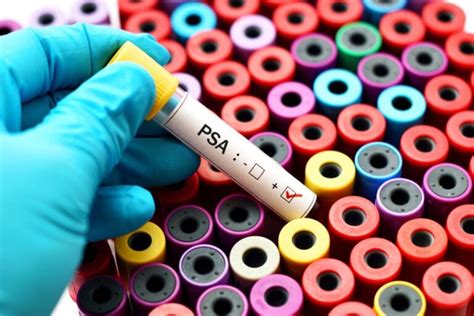 10 Causes of an Elevated PSA | Prostate Laser Center
