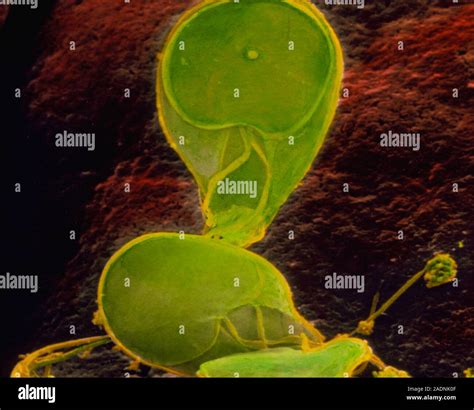 Giardia Lamblia Coloured Scanning Electron Micro Graph Sem Of The Parasite Giardia Lamblia