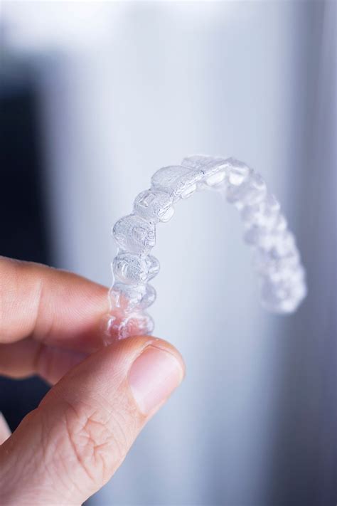 Clear Aligners Vs Traditional Braces Artofit