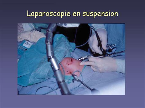 Ppt Anesthésie Pour Chirurgie Laparoscopique Chez L’enfant Powerpoint Presentation Id 4647739