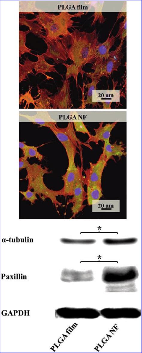 Protein Expression Of Cell Adhesion Proteins Confocal Imaging And