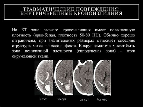 Лучевая диагностика в неврологии - презентация онлайн