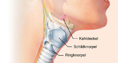 Kehlkopfentzündung Laryngitis was tun Apotheken Umschau