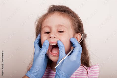 Dental medicine and healthcare - dentist examining little child girl ...