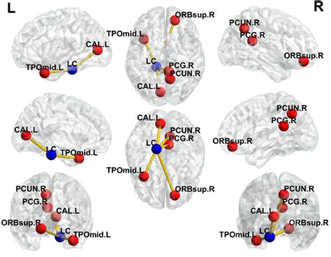 Visualization Of Brain Regions With Increased Functional Connectivity