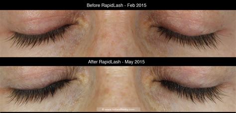 Rapidlash Review Latisse Comparison