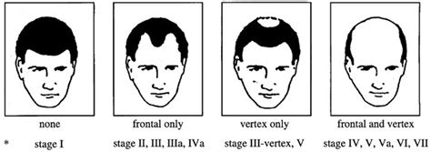 Comment On “androgenetic Alopecia Present In The Majority Of Patients