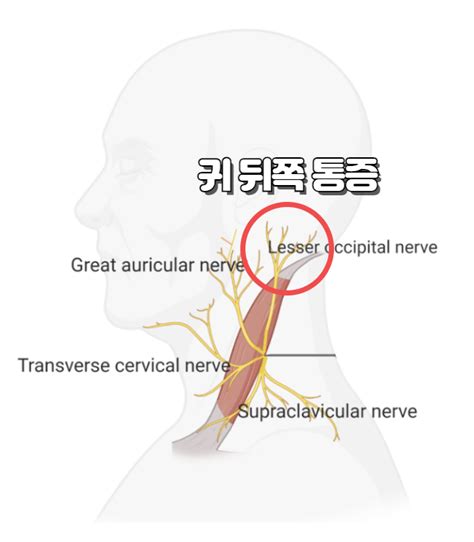 오른쪽 뒤통수통증 두피 찌릿 뒷머리두통 설명 후두신경통 치료 네이버 블로그