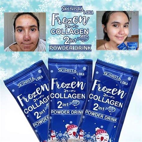 Collagen Drink Frozen Collagen In Skinista Bpom Sumplemen