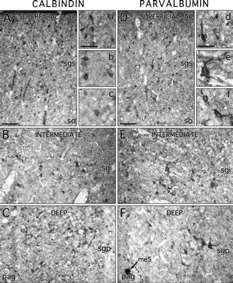 The Distribution Of Calbindin Left And Parvalbumin Right Download Scientific Diagram