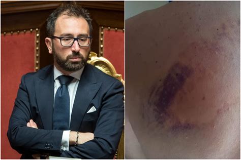 Pestaggi E Torture Nelle Carceri Bonafede Sapeva Della Repressione Per