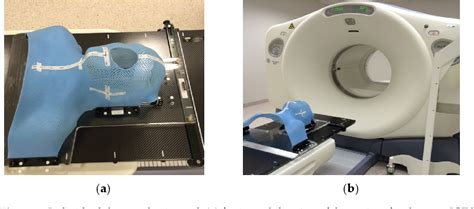 Figure 1 From Development Of A Model Based On Delta Radiomic Features