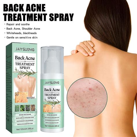 2023 New Jaysuing Back Acne Spray Back Acne Treatment Salicylic Acid