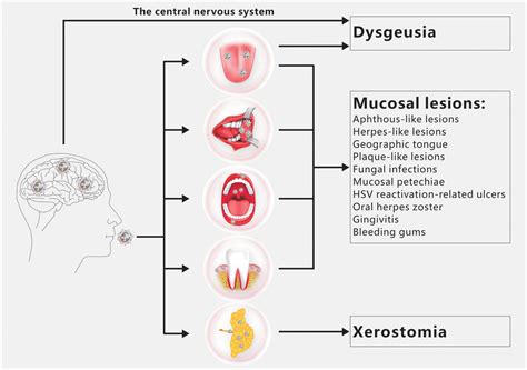 Frontiers The Oral Manifestations And Related Mechanisms Of COVID 19