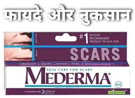 मेडरमा क्रीम के फायदे और नुकसान मेडरमा क्रीम कैसे लगाए Mederma Cream Uses In Hindi Grahak