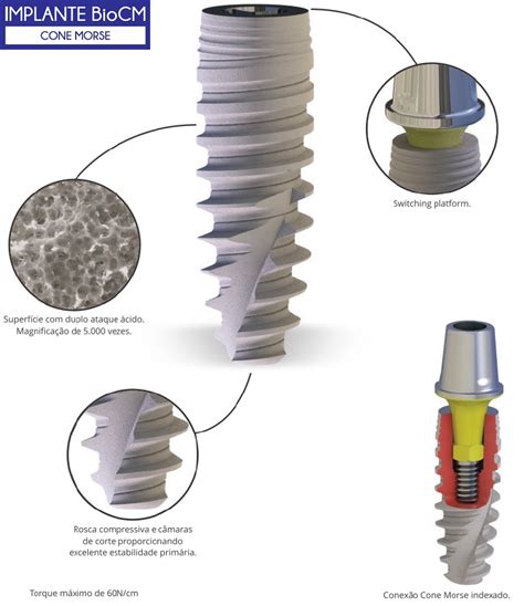 Implante Cone Morse Neodent Retoedu