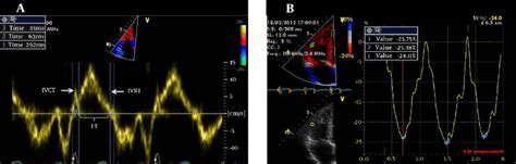 A Tissue Doppler Imaging Used For Calculating The Right Ventricular