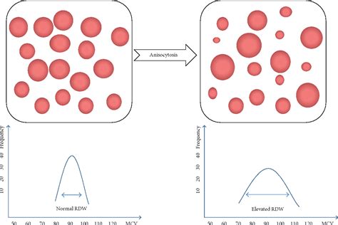 Red Blood Cell Distribution Width A Novel Predictive Indicator For