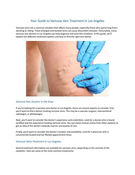 Ppt Your Guide To Varicose Vein Treatment In Los Angeles Powerpoint