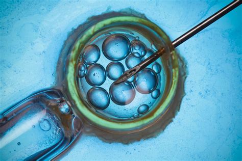 What Is Assisted Reproductive Technology Citizenside