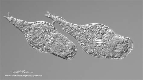 Photomicrography And Video Of Protozoa And Rotifers By Robert Berdan