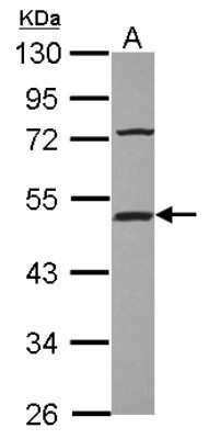 Hsp Interacting Protein Hip Antibody Nbp Novus Biologicals