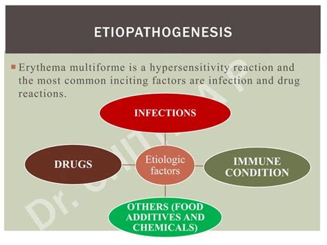 Erythema Multiforme Dr Chithra P Ppt