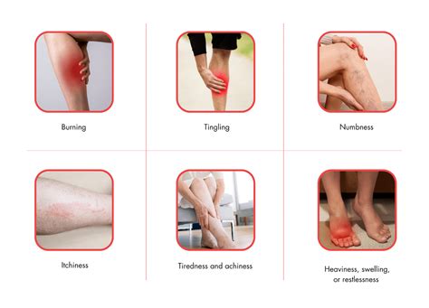 Managing Chronic Venous Insufficiency Symptoms At Every Stage