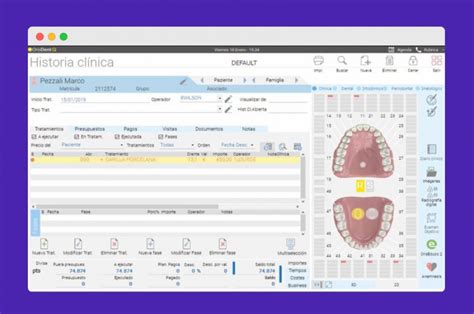 Mejores Softwares Para Dentistas Gratis