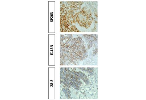 A Pairwise Comparison Of Pd L1 Score Between E1l3n 28 8 And Sp263