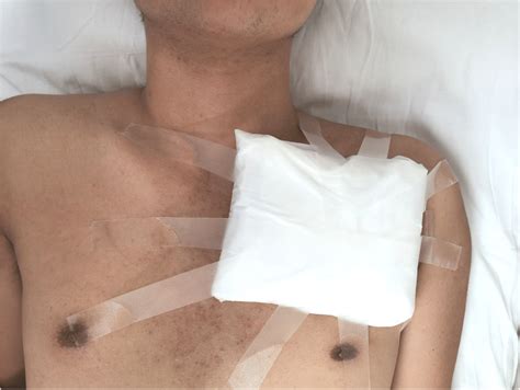 What Is In A Pressure Dressing At Wilda Talley Blog