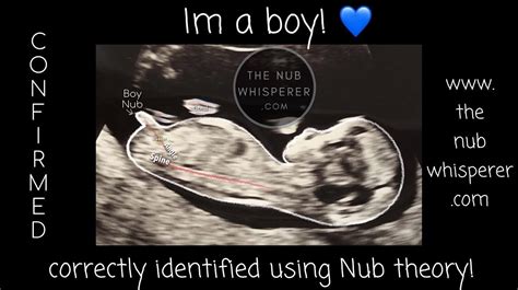 Baby Boy Confirmed Using Nub Theory 💙 Nubtheory Duein2020 Itsaboy💙