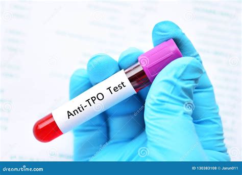 Tubo De La Muestra De Sangre Para La Prueba Anti Tpo Foto De Archivo