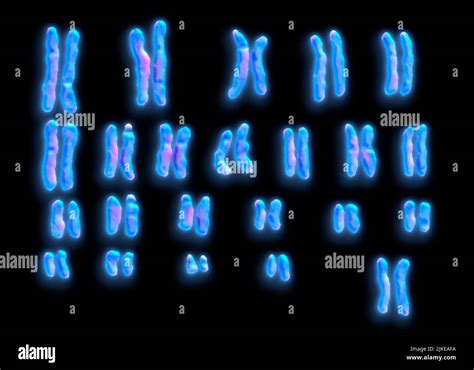 X Chromosomen Weiblich Fotos Und Bildmaterial In Hoher Aufl Sung Alamy