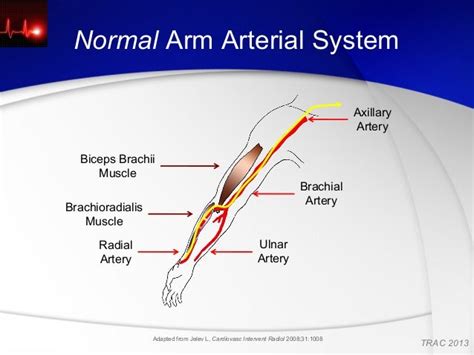 Gilchrist Ic Anatomy Of Radial And Brachial Arteries