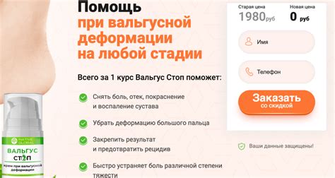 Вальгус Стоп : Valgus Stop Преимущества-Как использовать?-Russia