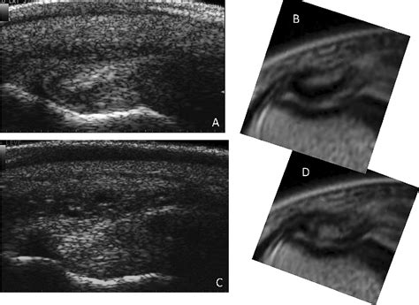 Figure 2 From Review Of Innovative Ultrasound Techniques For The