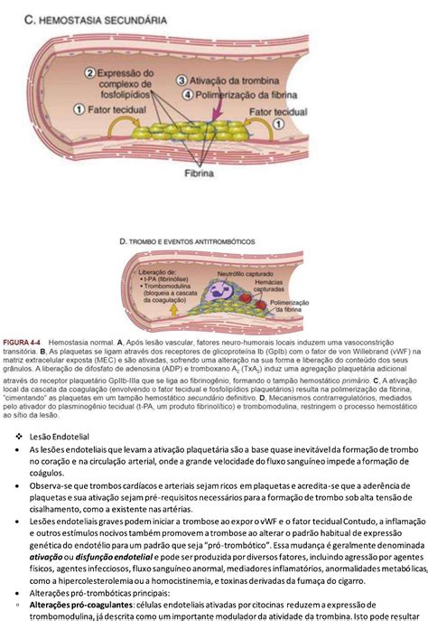 Trombo Embolo E Choque Patologia I