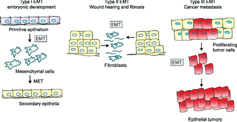 Three Types Of Epithelialmesenchymal Transition Emt Type I Emt Is