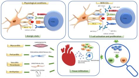 Cancers Free Full Text Cardiotoxicity Induced By Immune Checkpoint