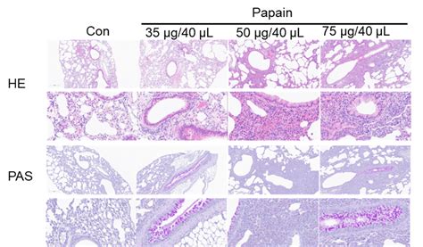 Acute Lung Injury And Inflammation Model Biocytogen