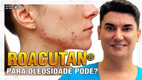 Roacutan para Oleosidade pode Sua Dúvida Vira Vídeo 30 YouTube