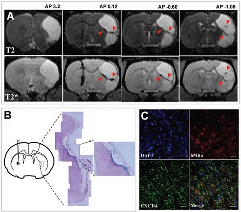 In Vivo Tracking Of 551 8 HiPSC Derived Neural Precursor Cells